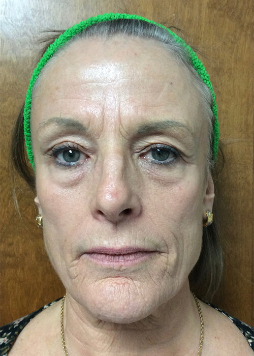 Zormeier Cosmetic Surgery and Longevity Center photo 3
