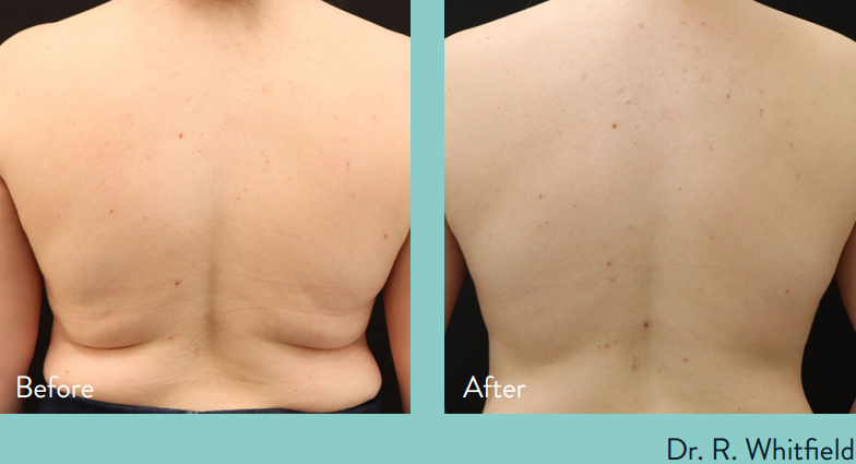 Zormeier Cosmetic Surgery and Longevity Center photo 4