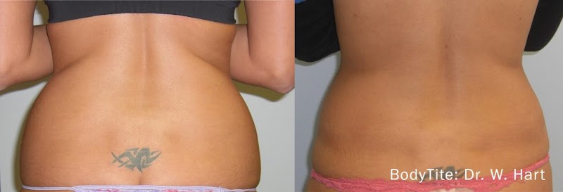 Zormeier Cosmetic Surgery and Longevity Center photo 2