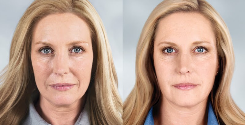 Zormeier Cosmetic Surgery and Longevity Center photo 5