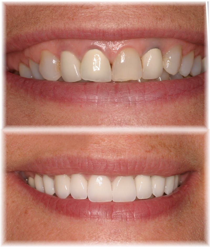 Dr. Randy Johnson's Center for Contemporary Dentistry - Vacaville Practice photo 2
