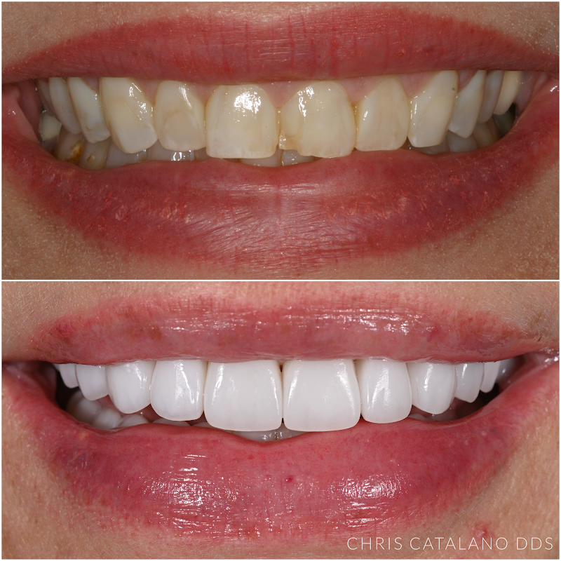 Christopher Catalano, DDS photo 3