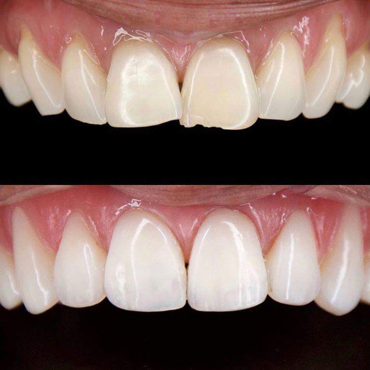 Autumn Lake Dental photo 2