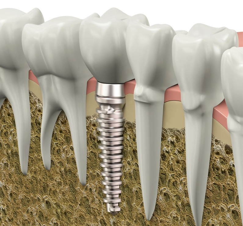 E Dental photo 5