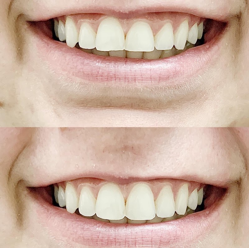 Carlmont Dental Care photo 3