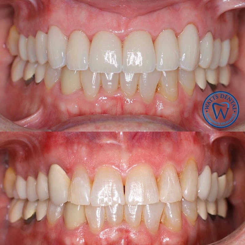 Watts Dental photo 2