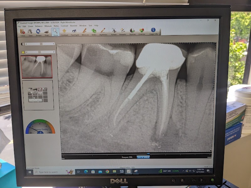 Endospecialists- Root Canal Specialist photo 2