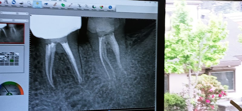Endospecialists- Root Canal Specialist photo 3