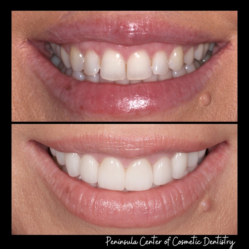 Photo of Peninsula Center of Cosmetic Dentistry Los Altos