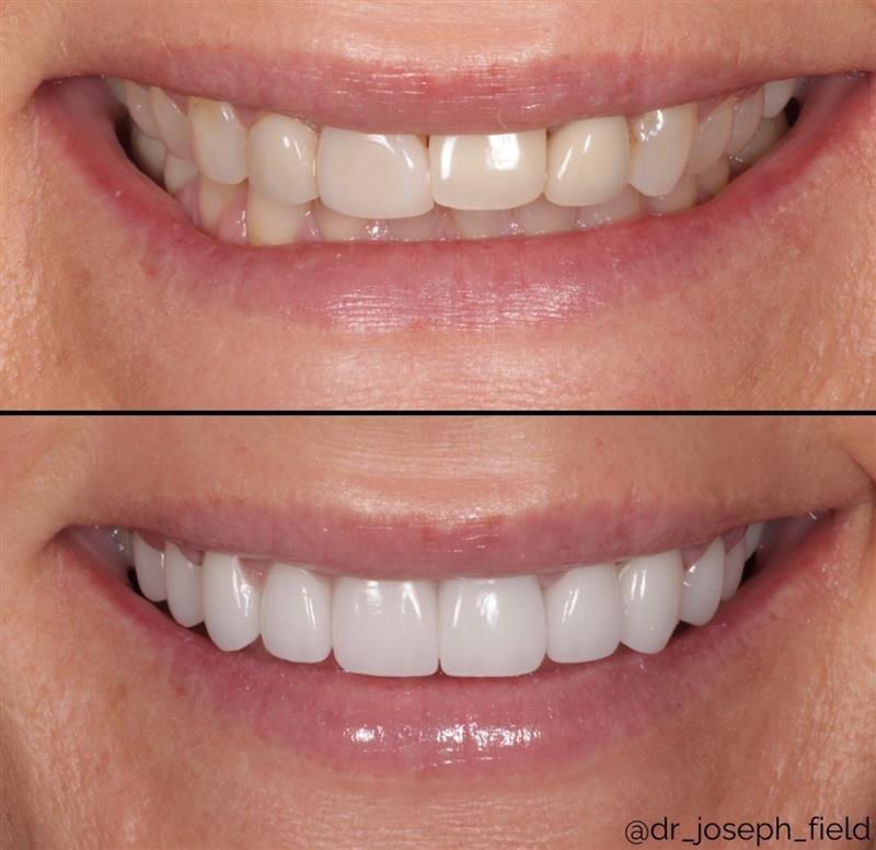 Dr. Joseph Field; Cosmetic Dentist photo 2