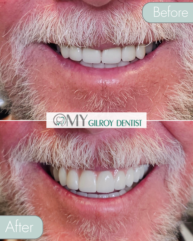My Gilroy Dentist, Amy N. Tran, D.D.S. photo 5