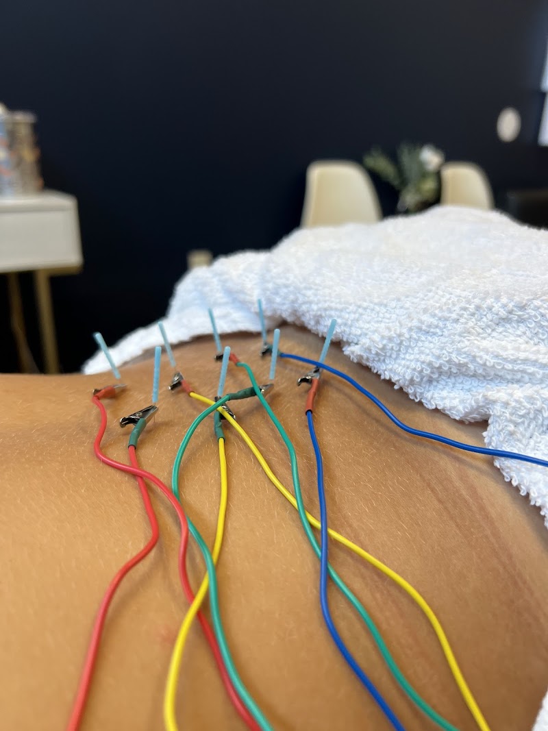 St Pete Dry Needling photo 3