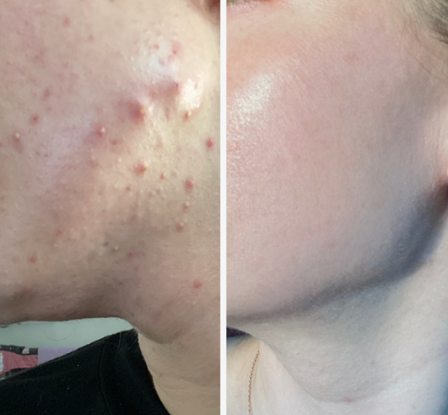 Brentwood Acne Clinic photo 2