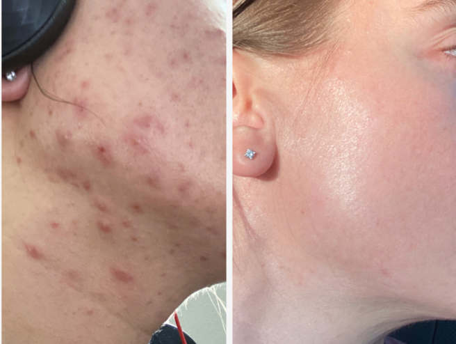 Photo of Brentwood Acne Clinic
