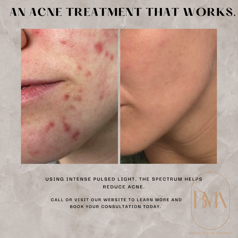 Benicia Medical Aesthetics photo 5