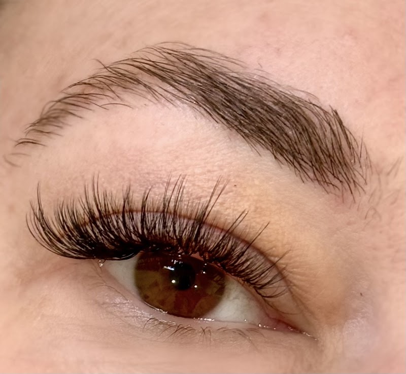 Photo of Beauty Marks