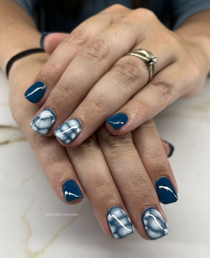Nail and Skin Remedies photo 4