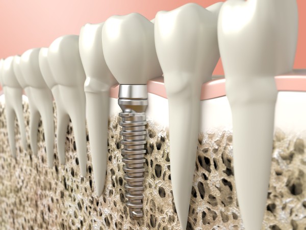 Trinidad Dental Care photo 2