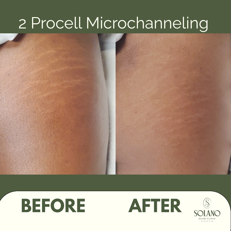 Solano Acne Clinic and Spa photo 5