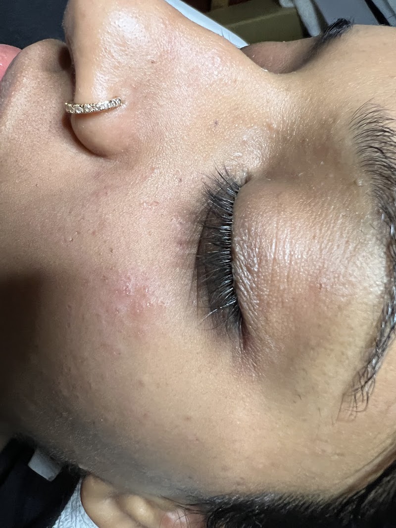 Facial by kim photo 5