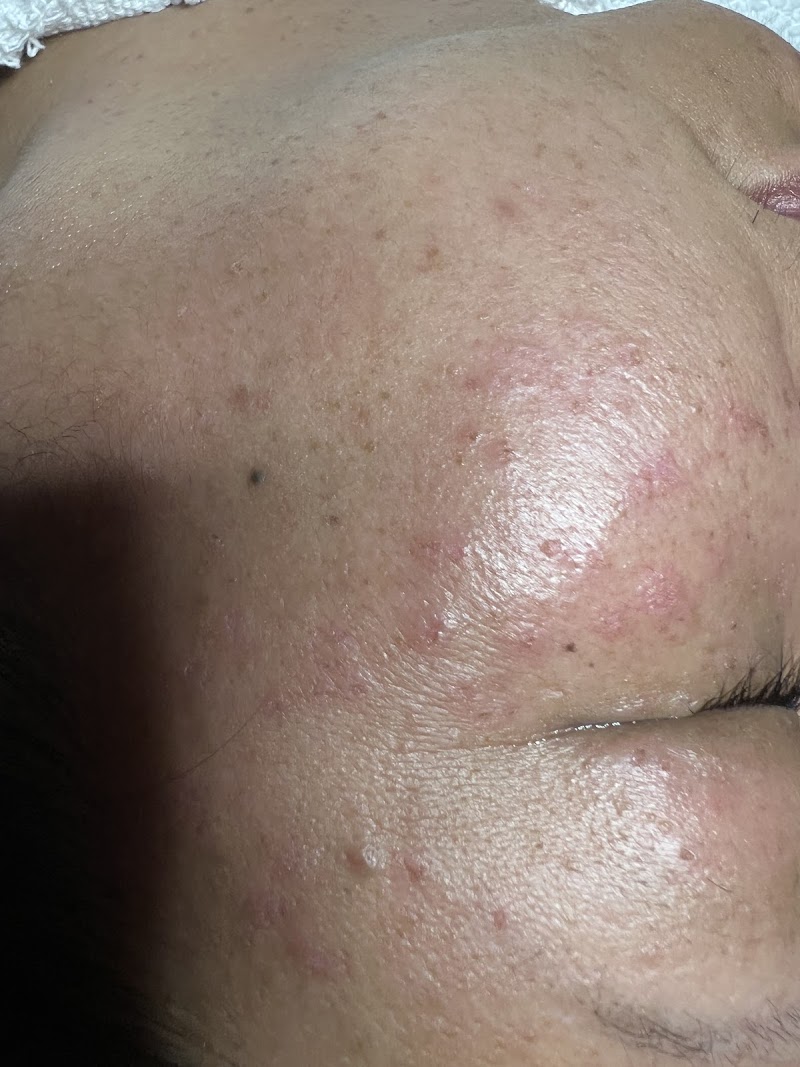 Facial by kim photo 4