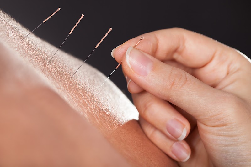 Yang's Acupuncture Clinic photo 3