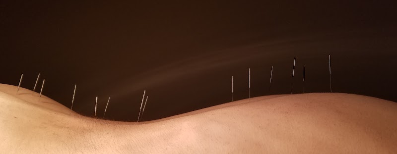 RISEWELL ACUPUNCTURE (online scheduling) photo 2