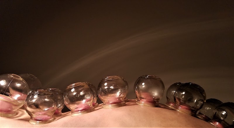 Photo of RISEWELL ACUPUNCTURE (online scheduling)