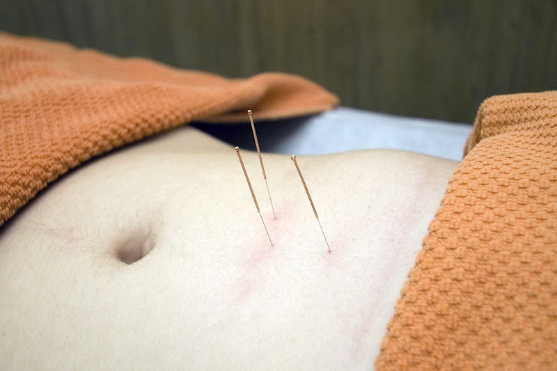 Photo of Golden Health Acupuncture