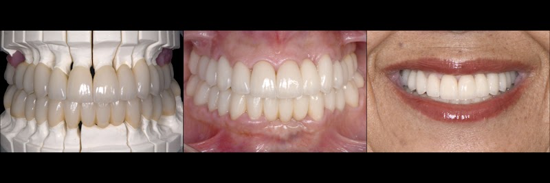 Bay Area Prosthodontics photo 2