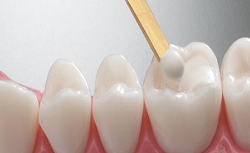 Dr. Jerry Yang, DDS photo 5
