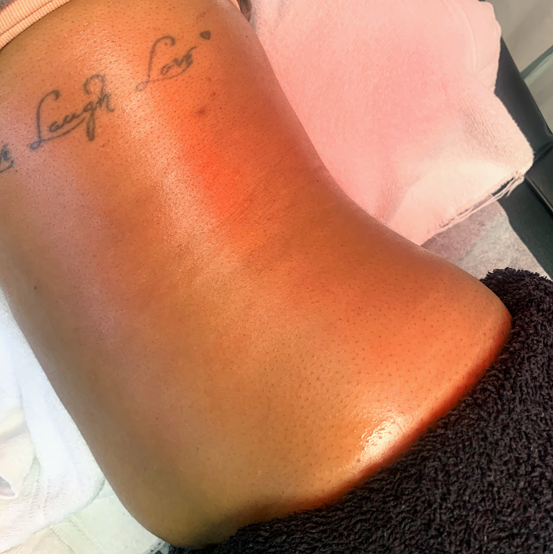 Tsiaw My Waist Body Contouring photo 3