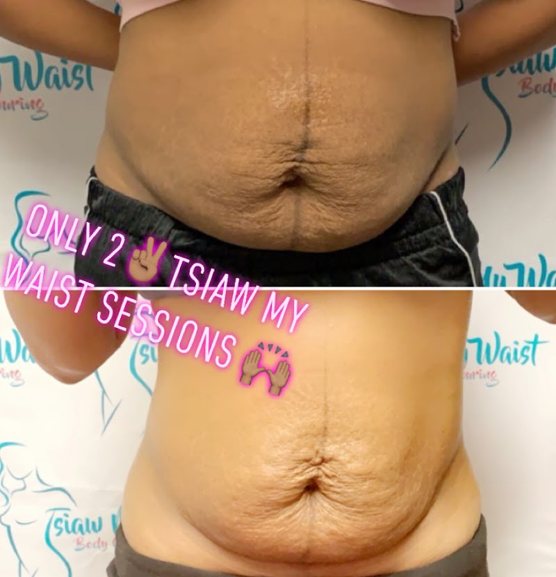 Tsiaw My Waist Body Contouring photo 2
