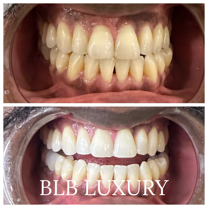 BLB LUXURY photo 3