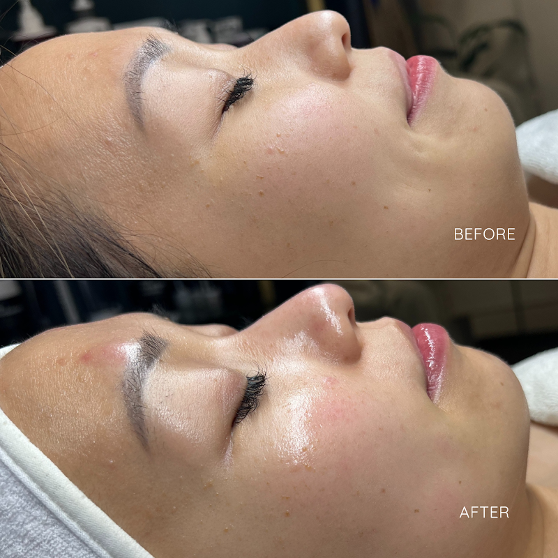 San Francisco Esthetics photo 2