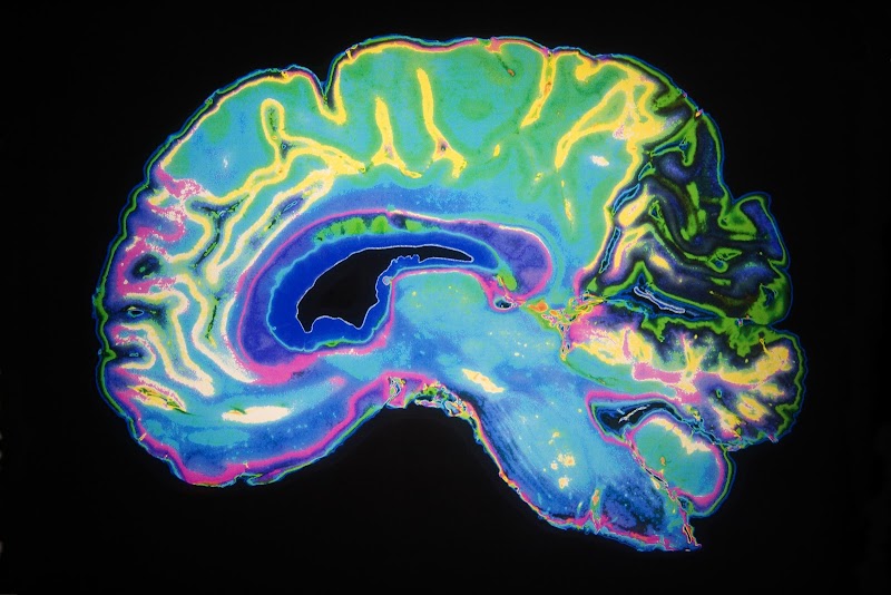 Sleep and Brain photo 4