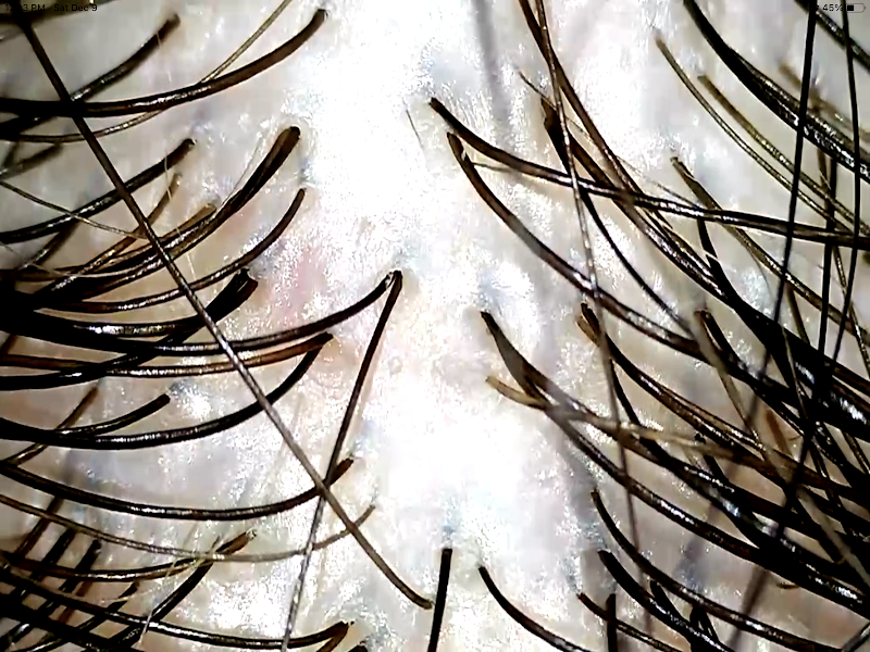 Evolve Scalp Health & Wellness photo 5