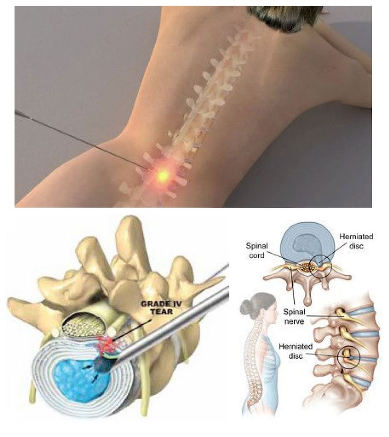Florida Advanced Spine & Orthopedics (FASTMD) photo 2