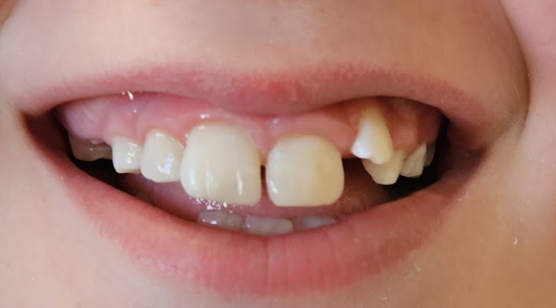 Walnut Creek Laser Dentistry photo 2