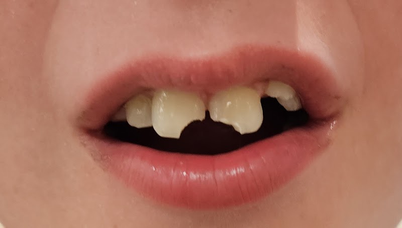 Walnut Creek Laser Dentistry photo 4