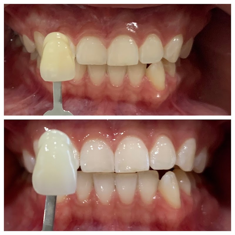 Elite Smiles and Dental Spa photo 4