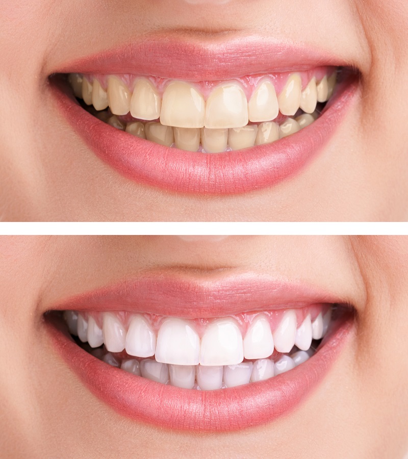 Gateway Dental Group photo 2