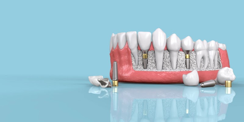 Gateway Dental Group photo 5