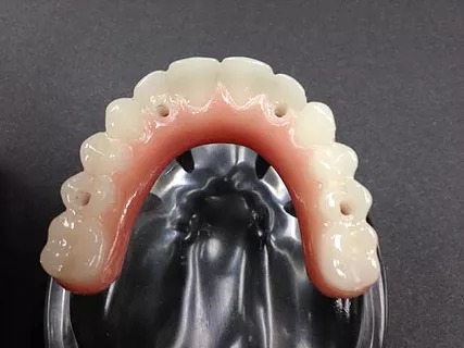 Value Dental Care photo 4