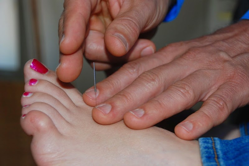 Lafayette Acupuncture & Functional Medicine photo 5