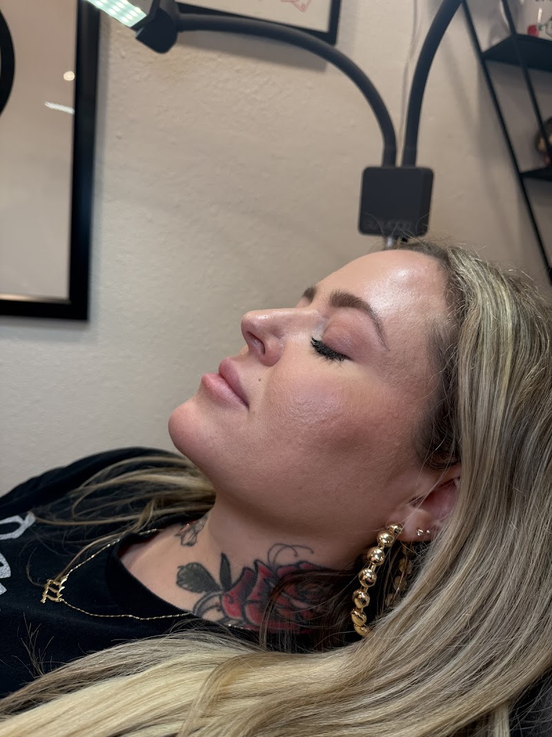 Botox with Erin photo 2