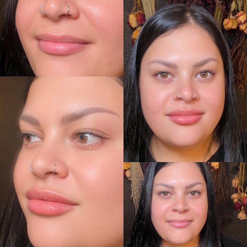 Botox with Erin photo 5