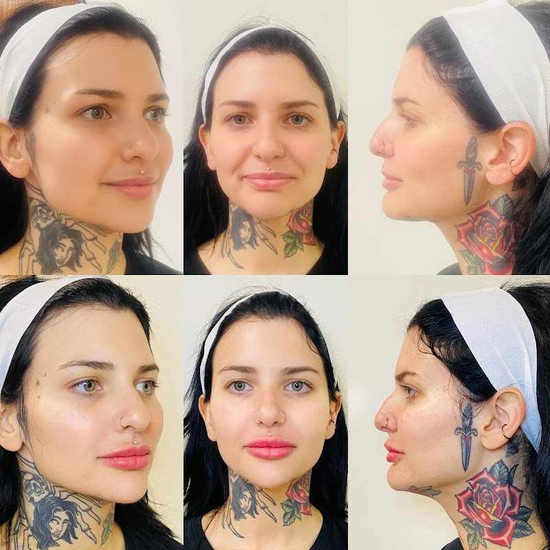 Botox with Erin photo 3