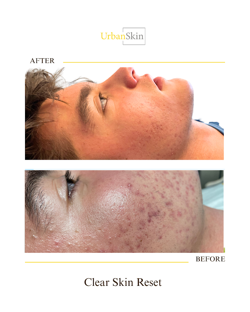 UrbanSkin photo 2