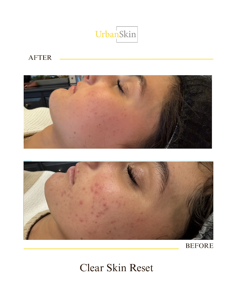 UrbanSkin photo 5